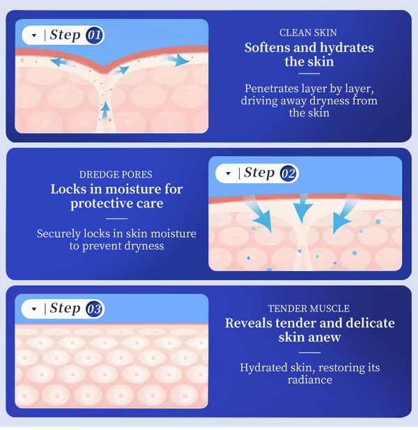 40% Urea CreamSpecifically for Hyperkeratosis,Ichthyosis, Psoriasis, and Eczema