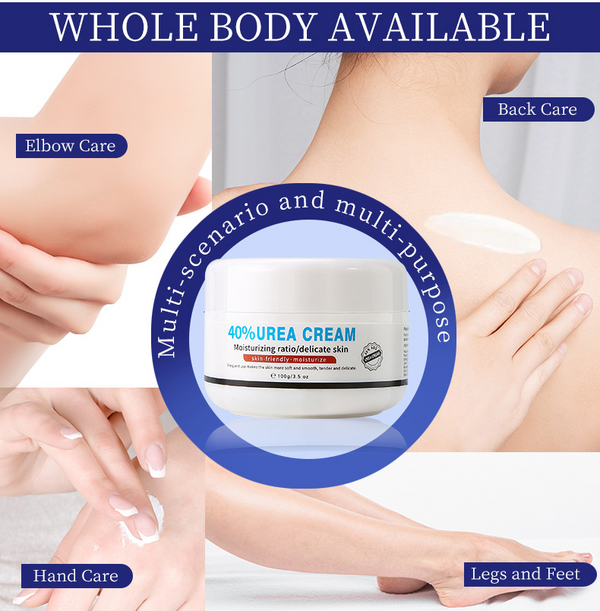 40% Urea CreamSpecifically for Hyperkeratosis,Ichthyosis, Psoriasis, and Eczema