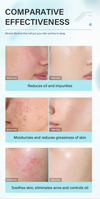 Tea Tree Salicylic Acid Oil Control Acne Removal Set-Prevent Rebound