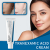 TX Tranexamic Acid CREAM | Skin freckle Cream
