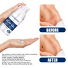 Advanced Silicore Scar Gel For Keloid, Hypertrophic, Surgical Scars & Stretch Marks