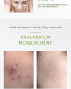 Salicylic Acid Acne Cleanser - Suitable for Both Dry and Oily Skin