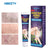 Maisu Massage Gel - Specialized for Varicose Veins/Spider Veins